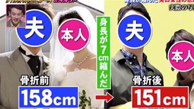 日本25歲小姐姐因害怕被曬黑，每天把自己包裹的像「木乃伊」！堅持2年後身高縮水了7cm！