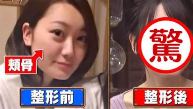 日本24歲女子，天生擁有可愛臉龐，卻被酸民噴「大餅臉」，砸60萬切掉骨頭大變身，網友：很有勇氣~