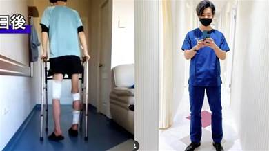 日本男子花500萬反復打斷骨頭，頂著終身殘障的風險只為增高10cm！