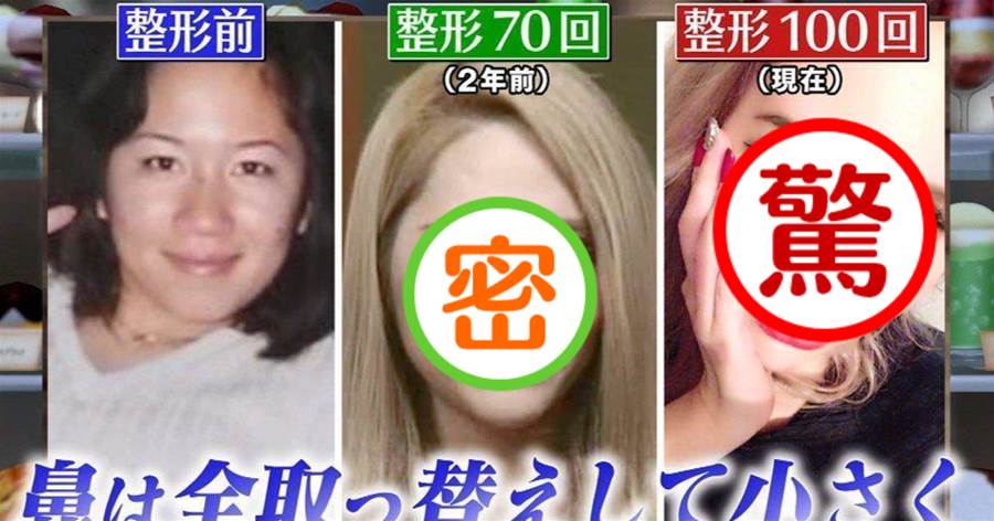 為了變美花4000萬整容上百次，日本50歲大媽成功換頭變「蛇精臉」！網友：還不如不整...