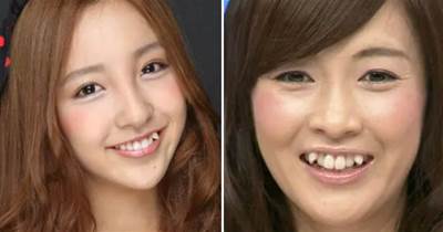 日本人故意花錢把牙齒弄得不整齊？外國網友一臉懵：究竟為啥？
